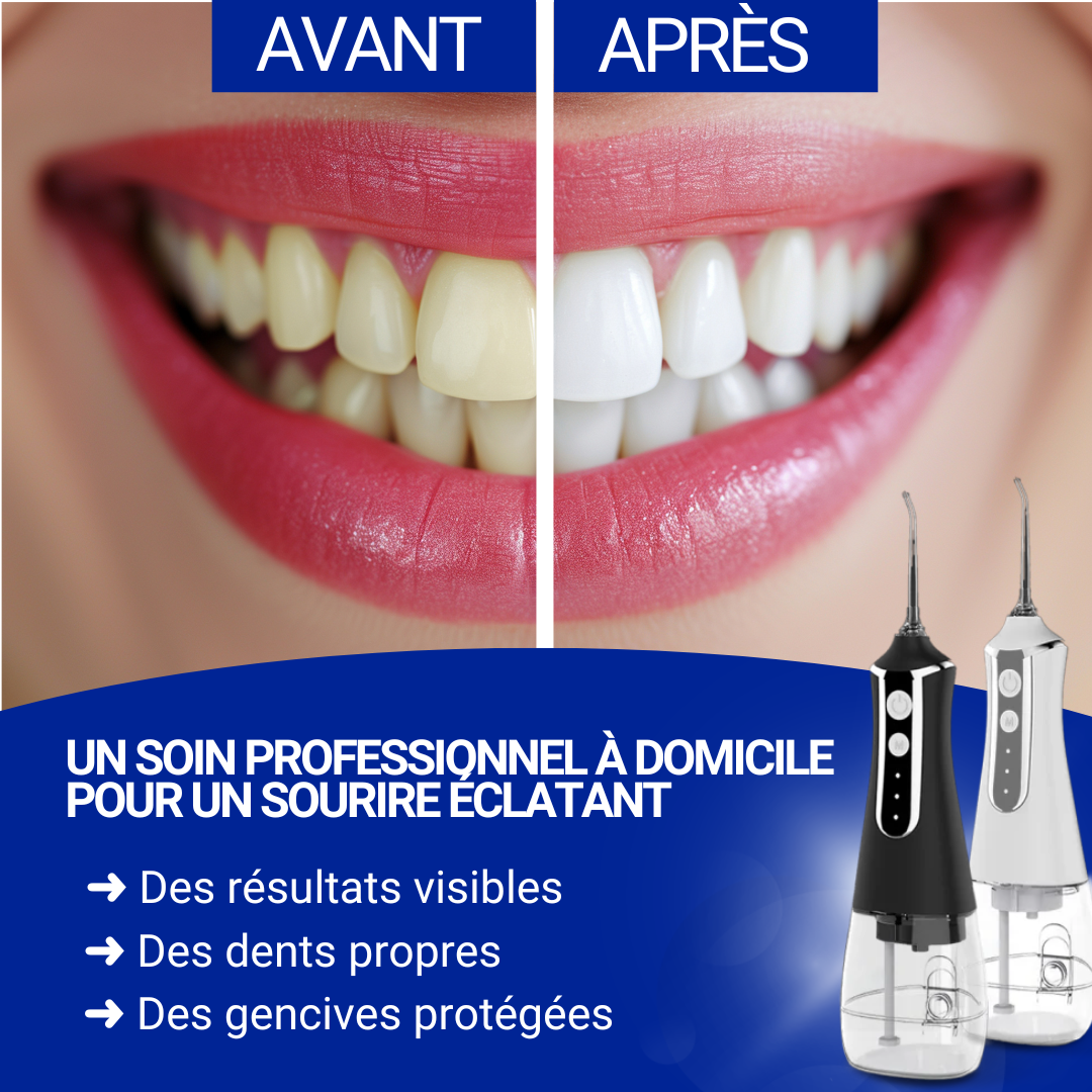 AquaFlossy Pro - Irrigateur Dentaire Haute Pression Pour Des Dents Éclatantes